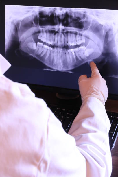 Best Emergency Dental Care for Broken or Chipped Teeth in Tamaqua, PA